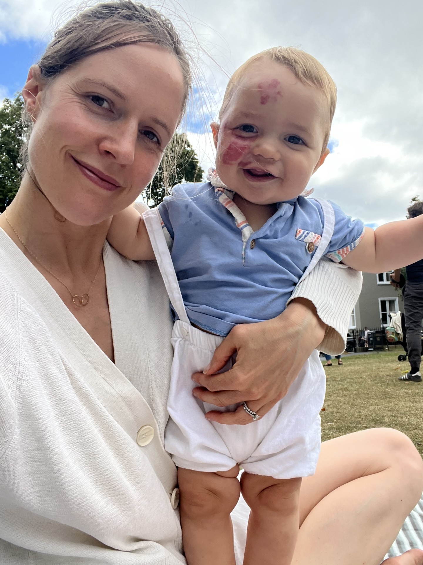 Emily holding her son Alexander, who has a port-wine stain birthmark
